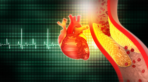 Neuroscience Heart and Stroke 2024 CNE Nursing Conference