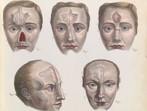 Profs & Pints Northern Virginia: The History of Plastic Surgery