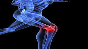5 Exercises to Reduce Knee Pain