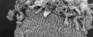 Learn How to Use a Scanning Electron Microscope