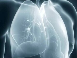 Breath of Hope Ohio - Lunch & Learn: Living Well with Lung Cancer