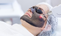 One Laser Skin Rejuvenation Hollywood Peels at dr LASER (Up to 88% Off)
