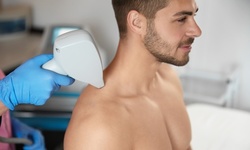 3 or 6 Laser Hair-Removal Sessions on 1 Small, Medium, or Large Area at Beauty Factory Spa (Up to 68% Off)