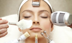 One or Three IPL Photofacials with Microdermabrasion Sessions or Glycolic Peels at Serena Spa (Up to 85% Off)