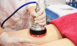 Up to 71% Off on Cavitation at Body You By Simone The Natural Way