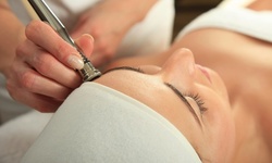 One, Two, or Three Diamond Microdermabrasion Treatments at New Skin Esthetics (Up to 68% Off)
