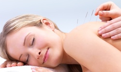 Acupuncture Treatments for Fertility, Weight Loss, and Stress at Manhattan Wellness Group (Up to 60% Off) 
