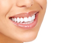 Dental-Exam Package for One or Two from Dr. Atusa Sedehi at Cliffside Park Dental Group (91% Off)