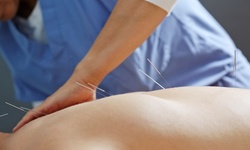 $29.62 for an Acupuncture Assessment and Treatment at Columbus Circle Acupuncture Wellness ($250 Value) 