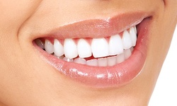 $37.13 for Dental Cleaning, X-ray and Exam with Dr. Geffen ($280 Value)