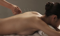 One or Three Acupuncture Session with Initial Assessment at New U Physical Therapy (Up to 60% Off)