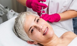PRP Treatments at ReDefine Aesthetics (Up to 75% Off). Four Options Available.