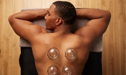 Up to 58% Off on Cupping at Horizon Integrative Medicine