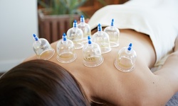 Up to 31% Off on Cupping at Heal. Pain and Stress Relief Center