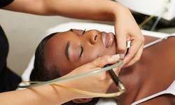 One, Three, or Five Microdermabrasion Treatments at Enigma Medi Spa (Up to 72% Off) 