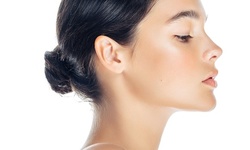 20 Units of Botox at Dr. Yuan Bariatric and Cosmetic Surgery (Up to 42% Off)