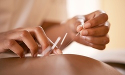 One or Three Acupuncture Sessions with Consultation at Melanie Miller Acupuncture & Chinese Medicine (58% Off)