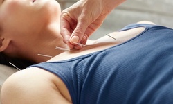 One or Two Acupuncture Sessions at Quest Chiropractic (Up to 67% Off)