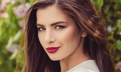 $503.50 for One Syringe of Restylane Kysse at Face Forward Aesthetics ($799 Value)