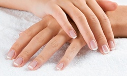 One or Two Syringes of Radiesse for the Hands at NeoVision (Up to 48% Off)
