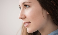 One or Three Chemical Peels or Microdermabrasion Treatments at Medical Cosmetic Enhancements (Up to 61% Off)