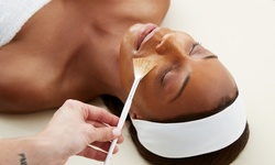 One or Three Chemical Peels or Diamond Microdermabrasion Treatments at The Medi Spa at Caraway (Up to 68% Off)