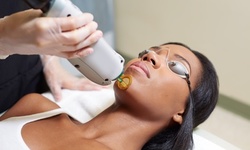 Six Laser Hair-Removal Treatments for a Small, Medium, or Large Area at Janelle MediSpa (Up to 93% Off)