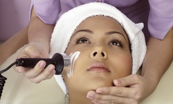 One, Three, or Six IPL Photofacials at Skyline Laser Spa (Up to 77% Off)