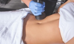 Up to 77% Off on Ultrasound - 3D / 4D at Infantsee4D