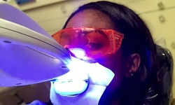 Up to 49% Off on Teeth Whitening - In-Office - Non-Branded at Gorgeous Smile PLLC