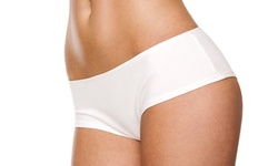 Two or Three Lipo-HIFU Fat-Reduction Treatments at Black Bella DC (Up to 52% Off)