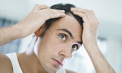 One or Three PRP Hair Restoration Treatments at Century Med Spa (Up to 51% Off)