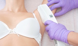 Three Laser Hair-Removal Sessions on One Small, Medium, or Large Area at Nush Skincare (Up to 87% Off)