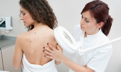 Removal of One, Two, or Three Skin Tags, Moles, or Warts at Lavenvelle Spa (Up to 67% Off)