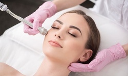 Microdermabrasion with Mask or Pomegranate Facial at Forevermore Skincare and Lashes (Up to 27% Off)