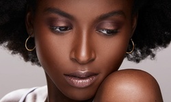 One or Two Fraxel Laser Skin Treatments at Renew MD Face and Body (Up to 73% Off)
