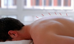 One or Two Acupuncture Treatments with a 30-Minute Massage at Kelian Family Chiropractic (72% Off)