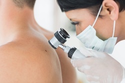 Three, Five, or 10 Mole, Skin Tag, or Spots Removal Sessions at Beauty Spa Soho (Up to 92% Off)