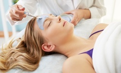One or Three Chemical Peels at NOVA Rejuvenation MD (Up to 76% Off)