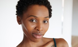 Microdermabrasion and Peels or Ultrasonic Facial at Bello Corpo Med Spa (Up to 71% Off). Four Options Available.