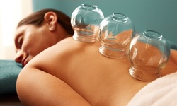 One or Three Cupping Therapy Sessions at Sports Performance Physical Therapy (Up to 52% Off)