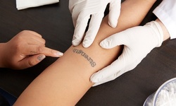 Three Laser Tattoo-Removal Sessions at ProMD Health (Up to 56% Off). Five Options Available.