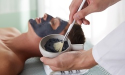 Carbon Laser Facial or IPL Photofacial Treatment at Faith Aesthetics (Up to 51% Off). Four Options Available.