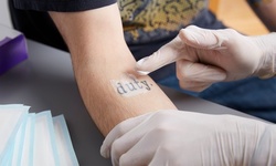 Three Laser Tattoo-Removal Sessions at Shining Way Esthetics (Up to 85% Off). Three Options Available.