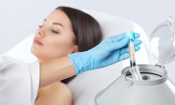 One Platelet-Rich Plasma Facials at dr LASER (Up to 74% Off)