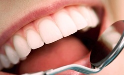 Up to 82% Off at Huntingdon Valley Dentistry
