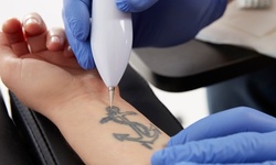Up to 60% Off on Tattoo Removal at BrigiBeauty llc.
