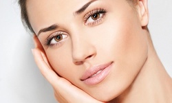 One, Three, or Five Nano Needling Treatments at Skinluxe (Up to 51% Off)