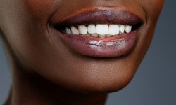 $24.65 for $2,000 Toward Full Invisalign Treatment at Signature Smiles