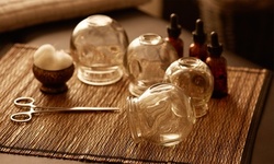 Up to 23% Off Acupuncture at Zenith Health Works